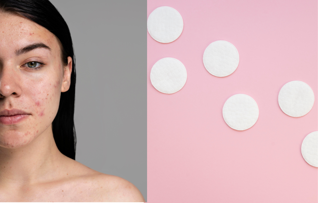 pimple-patches-bewellmag.com